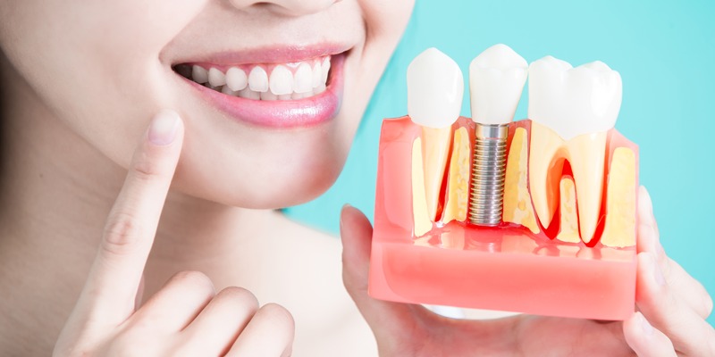 人工植牙、裝假牙哪個比較好？搞懂植牙流程、費用及注意事項