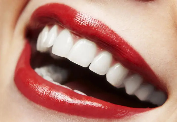 全瓷冠適合絕大多數尋求牙齒美容和功能性修復的人士